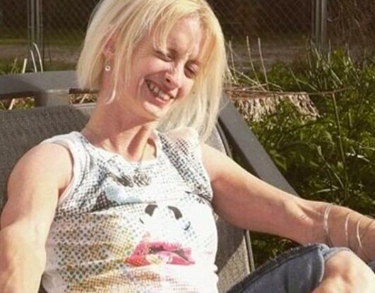 41 yaşlı qadın amansız xəstəliyə tutuldu: Hər gün qocalır - FOTOLAR