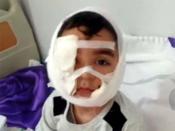 Распространены кадры с мальчиком, покусанным бешеной собакой в Баку (ВИДЕО)