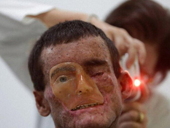 Bu qəsəbənin sakinlərini gün işığı əridir - Dəhşətli görüntülər - FOTO