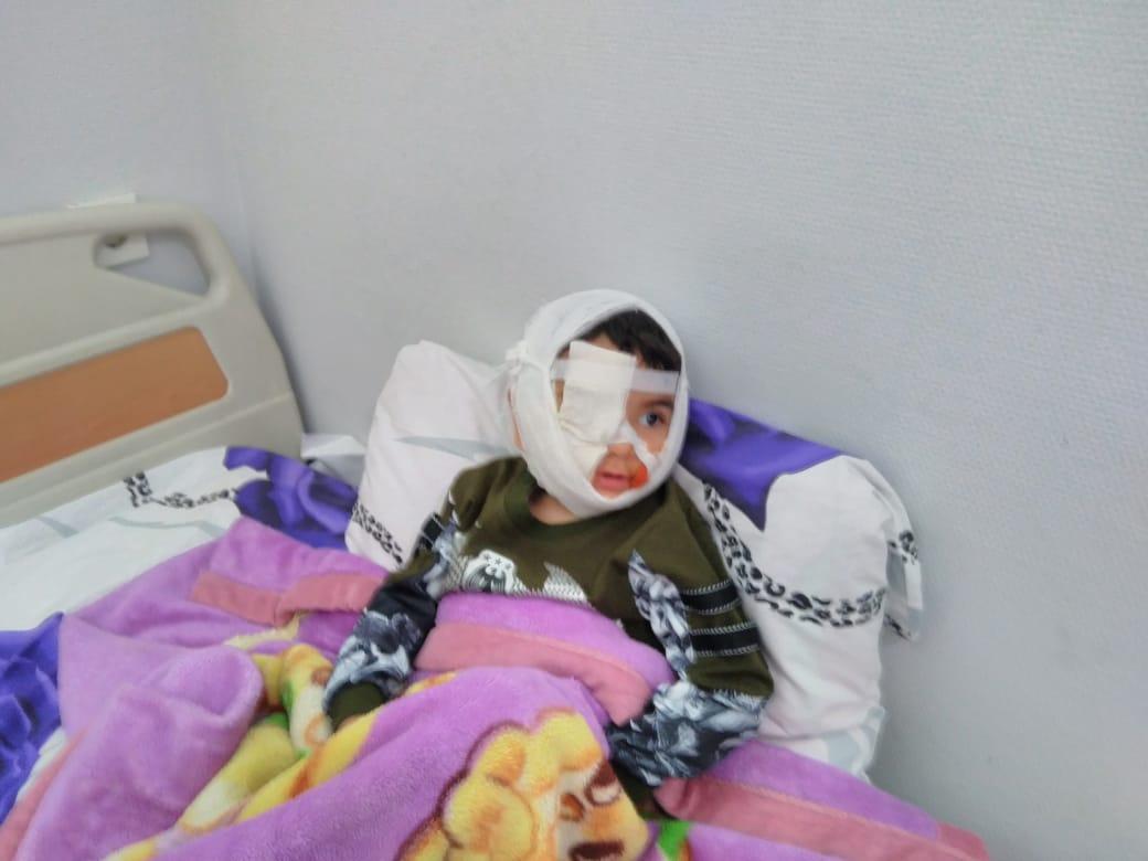 У покусанного собакой четырехлетнего Гусейна нет признаков бешенства - врач