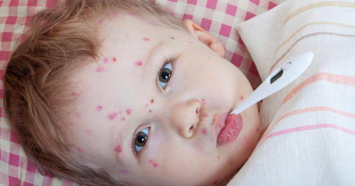 В Азербайджане уменьшилось число случаев заражения корью