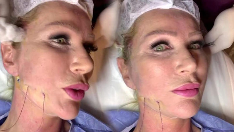 Üzünü dartdıran məşhurun QORXUNC GÖRÜNTÜLƏRİ – FOTO