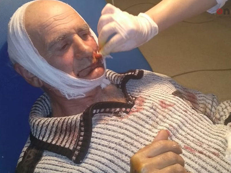 Azərbaycanda quduz itin 9 nəfəri dişlədiyi həmin DƏHŞƏTLİ ANLAR - VİDEO