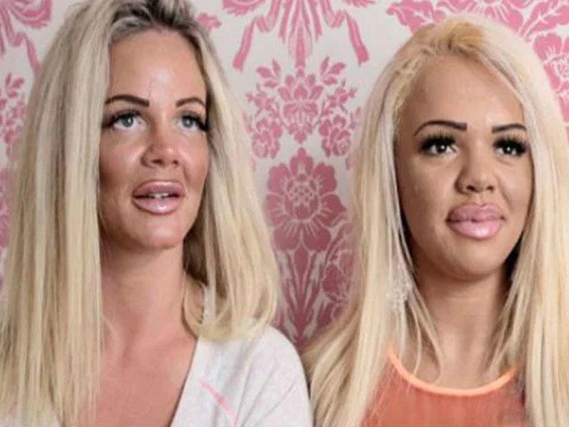 Plastik əməliyyat üçün qızını fahişəliyə məcbur edən ananın FOTOLARI