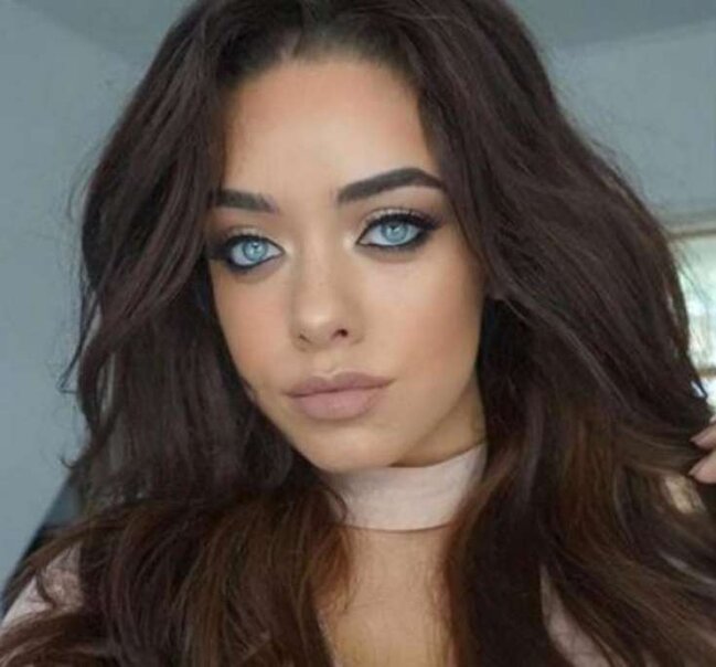 Cəzbedici gözəl estetik əməliyyatla görün nə günə düşdü? /FOTO