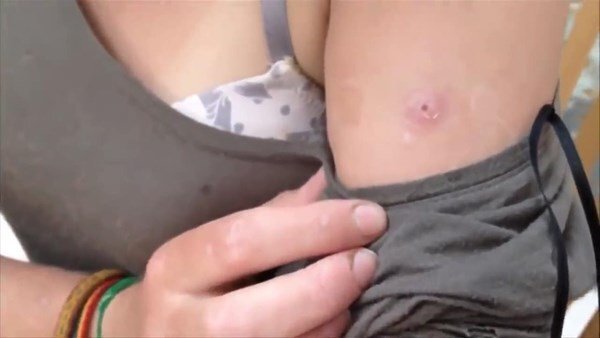 Həkimə müraciət etdi, qolundan çıxanları görənlər dəhşətə gəldi - FOTOLAR