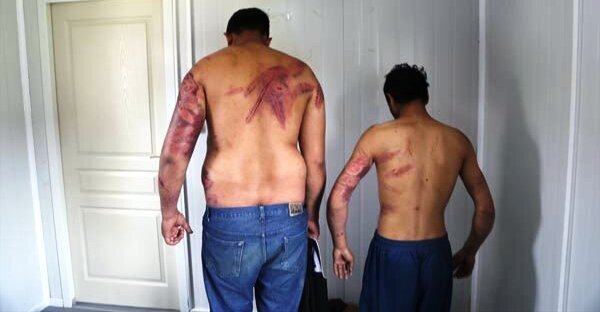 Bu foto görənləri dəhşətə gətirdi: Yarıçılpaq kişiləri vəhşicəsinə döydülər, zorla...