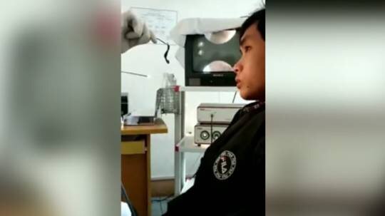 Burun ağrısı şikayəti ilə həkimə getdi, içindən çıxanlar şok yaratdı