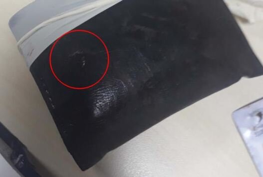 Cibindəki pul kisəsi baxın nəyə səbəb oldu? - fotolar