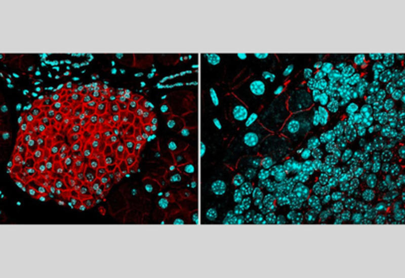 Найден способ предотвратить смерть от рака