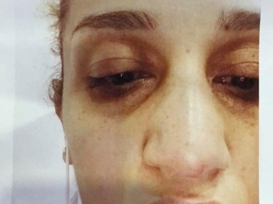 SON DƏQİQƏ: Bakıda anaya lesbi adı qoyub uşaqlarından ayırdılar - FOTOLAR