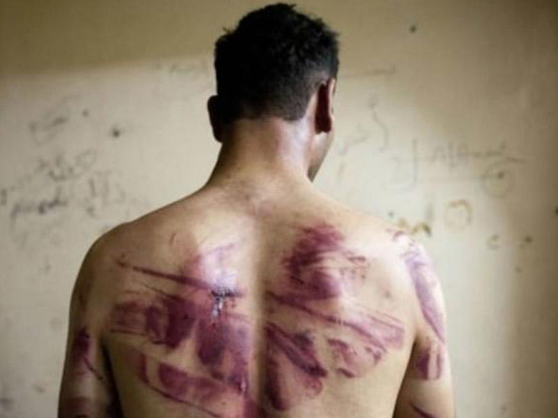 Tükürpədən cinayətlər - diri-diri yandırıldı, zorlandı və...