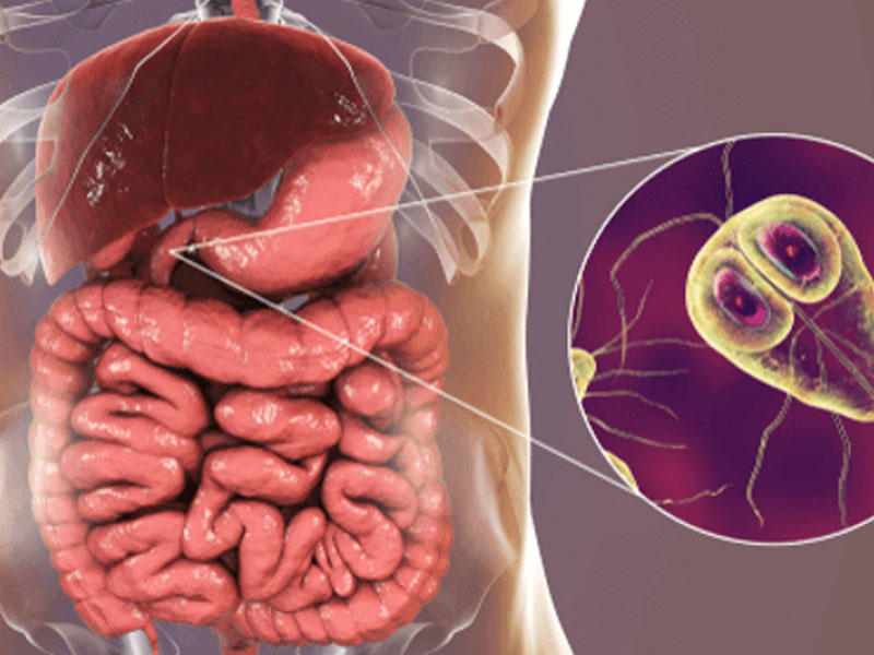 Lyambliyoz nədir, necə yoluxur? – QORXULU VİRUSUN ƏLAMƏTLƏRİ
