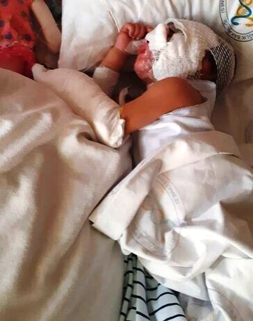 Bakıda üzərinə benzin tökülən 2 yaşlı Anjelanın SON HALI - FOTO