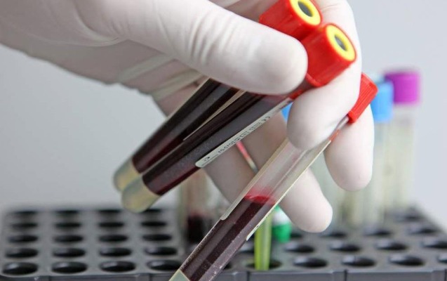 Məşhur alim xərçəngin yaranma SƏBƏBİNİ AÇDI