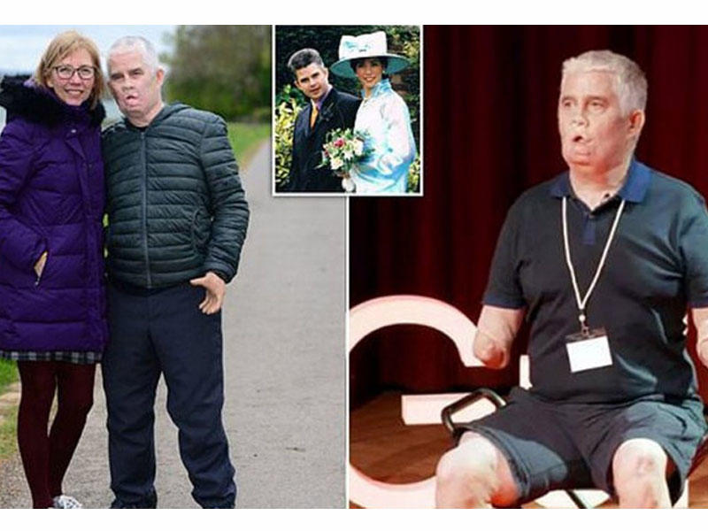 Diş həkiminə gedəndən sonra əl və ayaqlarından məhrum olub