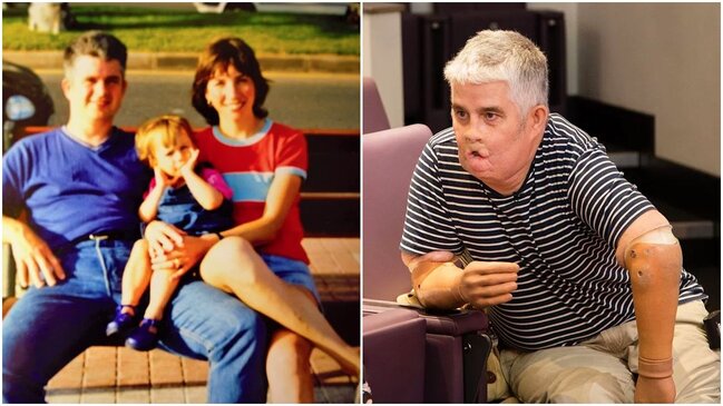 3 ay komada qaldıqdan sonra ayıldı, qolları, əlləri və üzünün kəsildiyini gördü - şok