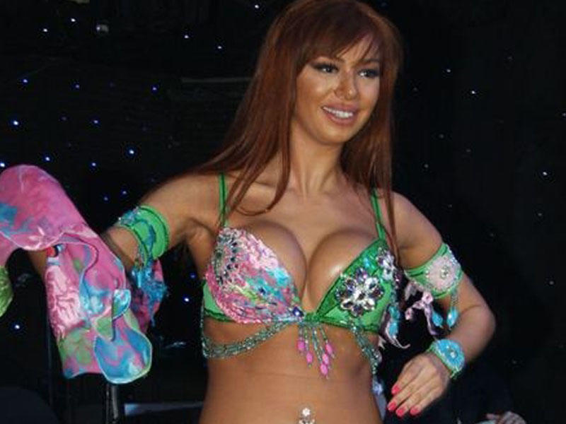 Silikon qoyduran rəqqasə tanınmaz dərəcədə dəyişdi - FOTO