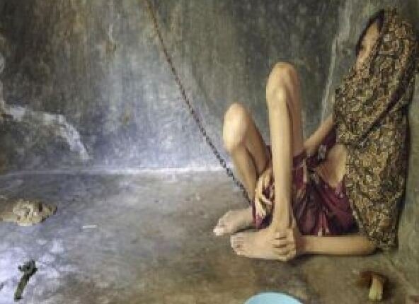 Azərbaycanda TÜKÜRPƏDƏN OLAY! Ana qızını it kimi zəncirləyib ağaca bağladı - FOTO