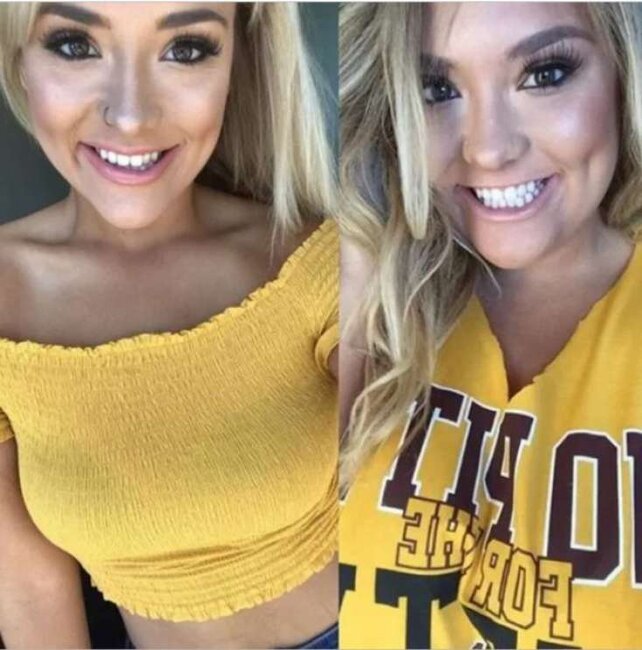 Artıq çəkisindən xilas olan qadın bu hala DÜŞDÜ - FOTOLAR