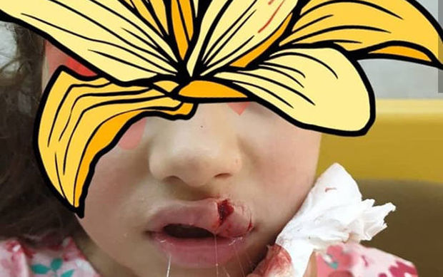 Novxanıda 6 yaşlı uşağı restoranda it dişləyib