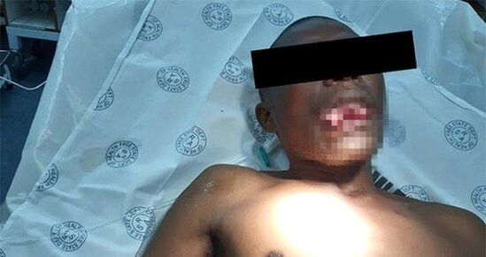 Qadın həkim ona təcavüz edən xəstənin dilini qopardı: DİŞİ İLƏ... (+18 FOTO)