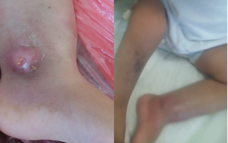 “Medi Lux”də körpəni qorxulu virusa yoluxdurdular – Mehriban Əliyevaya müraciət - FOTO