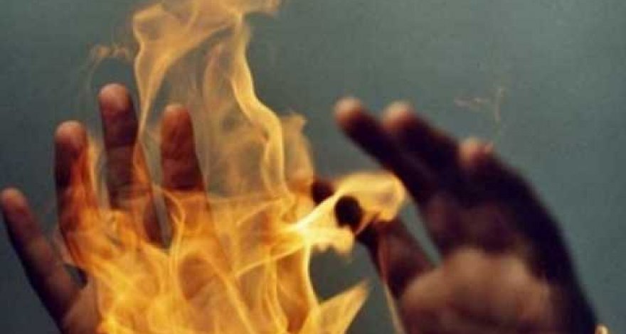 Пьяная москвичка сожгла одежду, чтобы привлечь внимание мужа