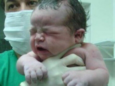 Azərbaycanda sağ tərəfdə orqanları olmayan uşaq dünyaya gəlib - FOTOLAR