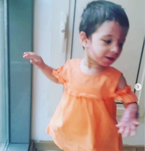 Üzərinə benzin tökülən 2 yaşlı Anjelanın SON HALI - FOTOLAR