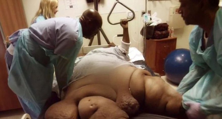 Женщина сбросила 200 килограммов и впервые за долгие годы встала с дивана