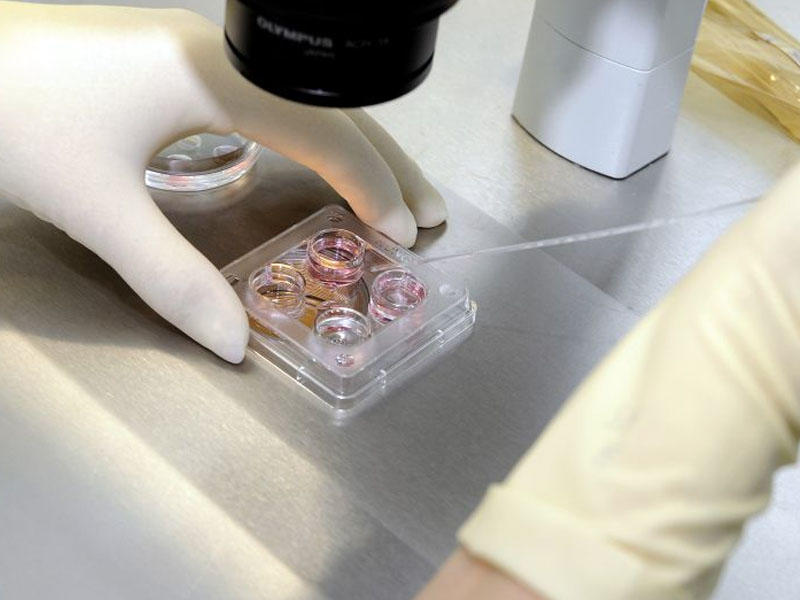 Narkomanlar arasında QİÇS-ə tutulmuş insanlar var? - Səhiyyə Nazirliyi açıqladı?