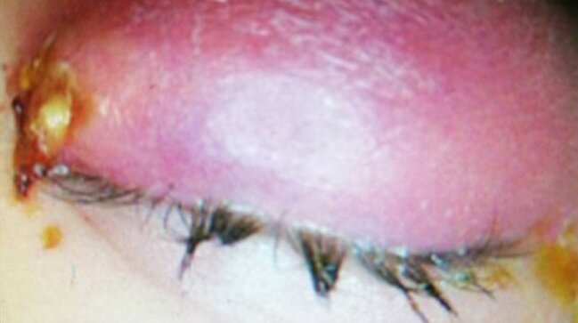 28 yaşlı qadının gözündən çıxanlar ŞOK ETDİ - FOTOLAR