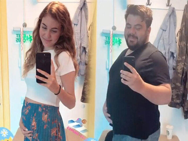 Yenicə toyu olan aktyor hamilə pozasında şəkil çəkdirdi - FOTO
