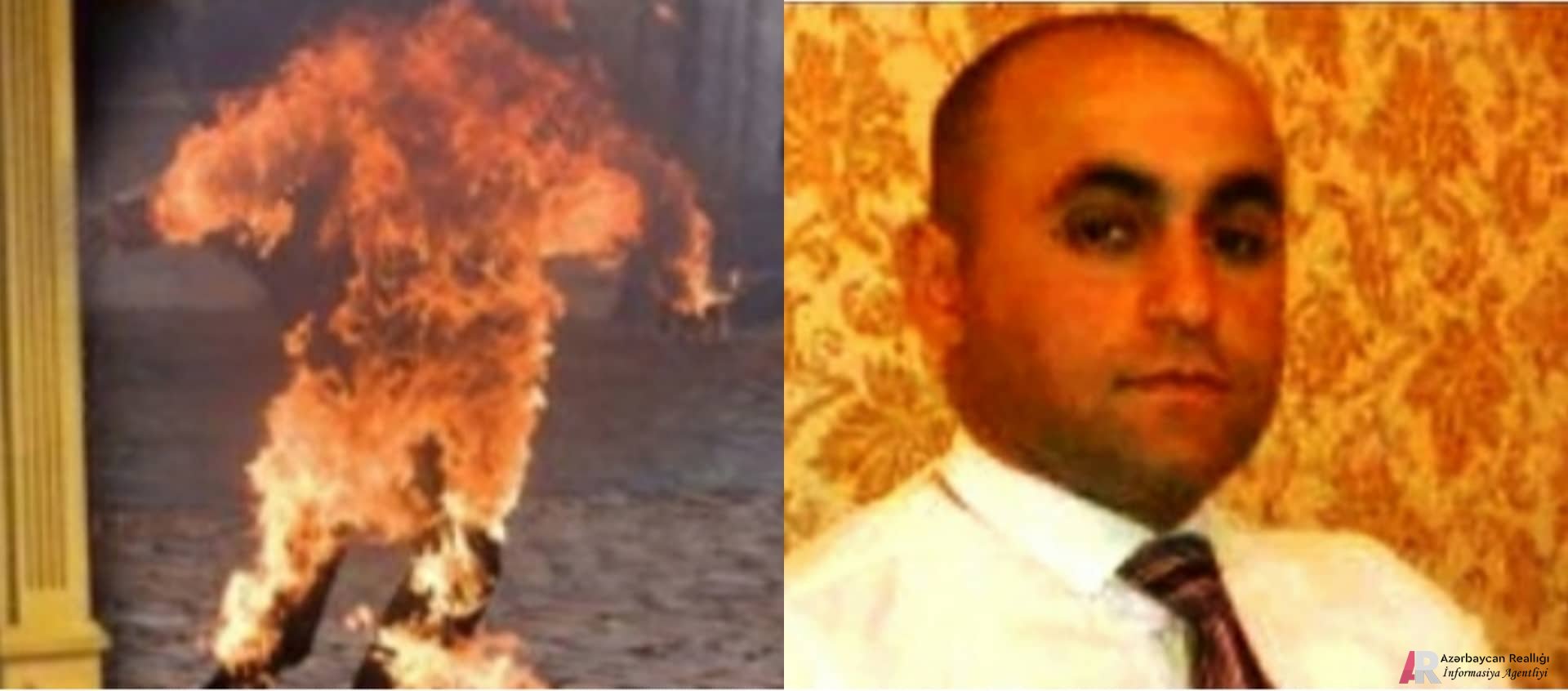 Mingəçevirdə özünü yandıran aprel qazisi vəfat etdi - İcra başçısı hadisəni gizlətməyə çalışır