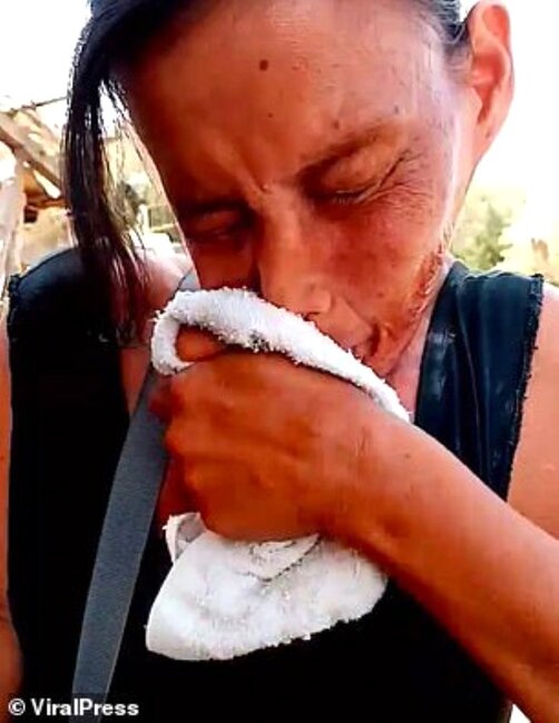 Görülməmiş hadisə! 15 ildir bu vəziyyətdə yaşayır - FOTOLAR