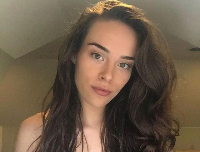 Bədəninin tüklərini 1 il qırxmayan qızın FOTOları hər kəsi ŞOKA saldı