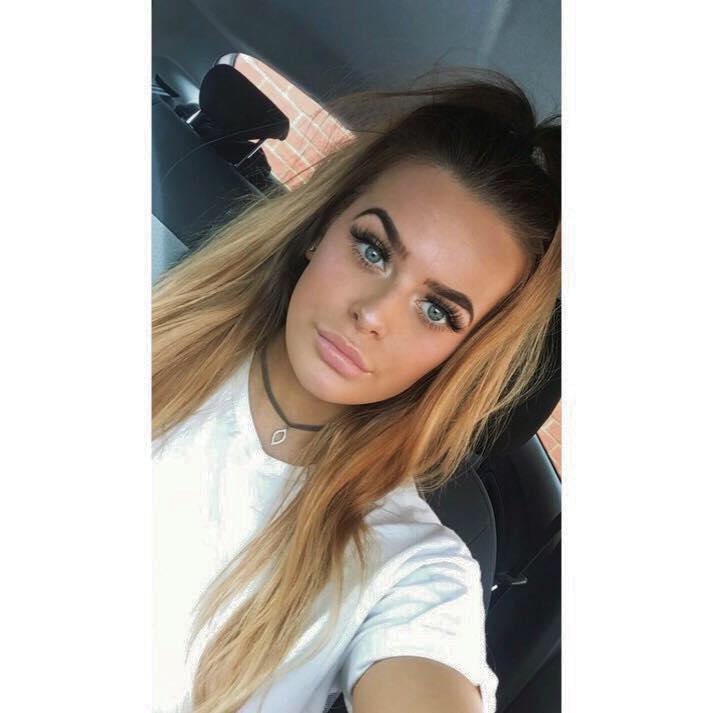 Ağzında yaralar çıxdı, dəhşətli diaqnoz qoyuldu - Ağıziçi xoraların qorxulu səbəbi