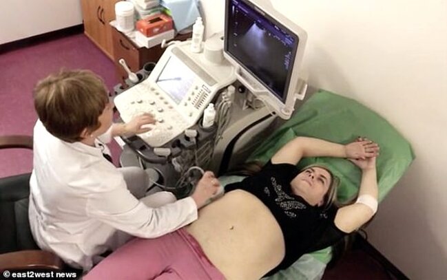 33 yaşlı qadının hamiləlikdən sonra başına gələnlər hər kəsi ŞOK ETDİ - FOTOLAR