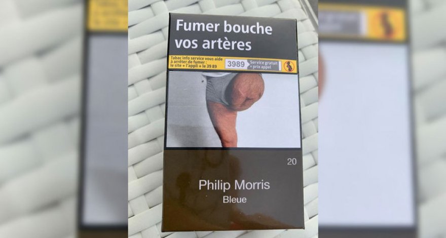 Житель Франции обнаружил на сигаретах фотографию своей ампутированной ноги