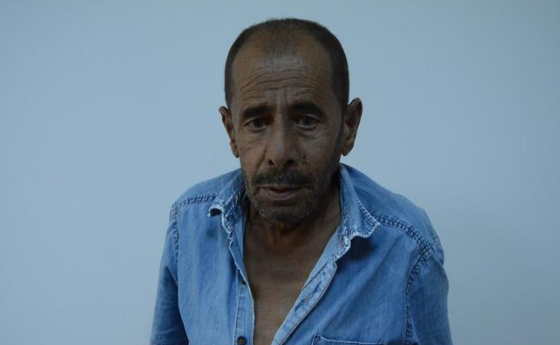 Bu kişi nadir xəstəliklərdən birinə tutuldu: qolları öz-özündən şişir