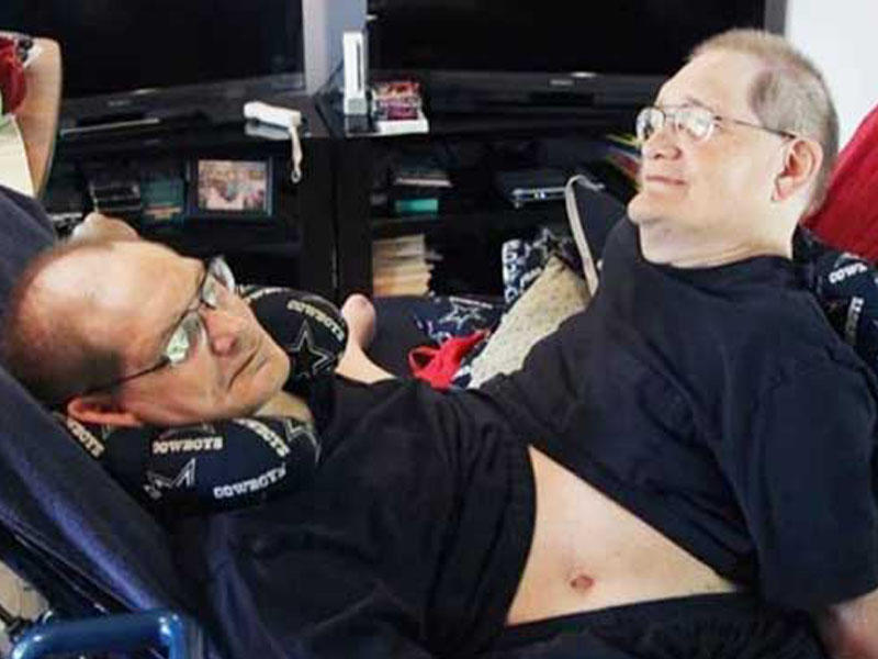 Dünyanın ən qoca Siam əkizlərindən biri ölsə, digərini öldürməli olacaqlar - FOTO