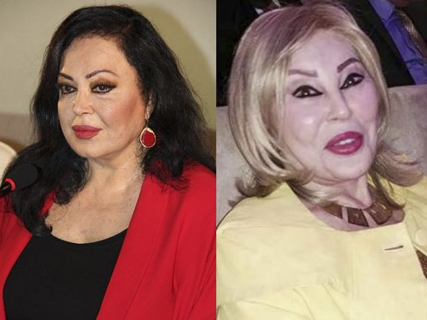 Türkan Şorayla Amaliya Pənahovanın plastik əliyyatdan əvvəlki fotoları görənləri heyrətə saldı-FOTOLAR