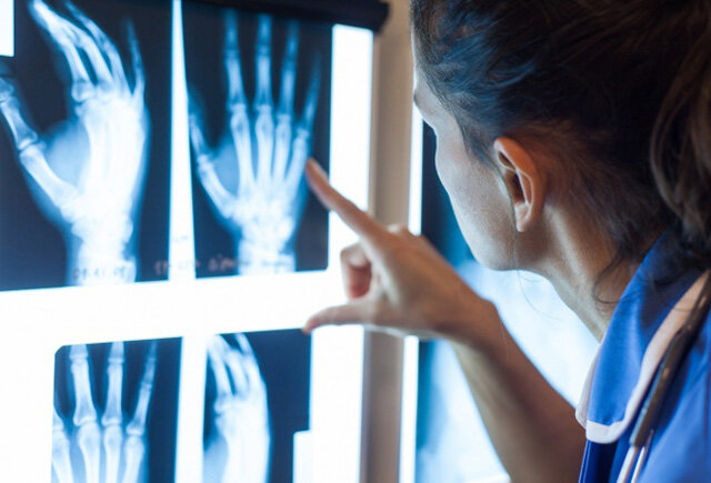 Rentgen və tomoqrafiya xərçəngin riskini artırır - Diqqətli olun!