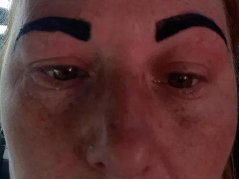 Kosmetoloq qadının qaşlarını bu hala saldı - 