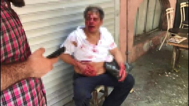 10yaşlı oğlana təcavüz etdiyinə görə görün hansı vəziyyətə saldılar - DƏHŞƏTLİ FOTO