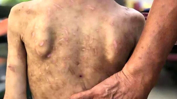 Nənənin nəvəsinə qarşı DƏHŞƏTLİ ƏMƏLİ - Ətini kəlbətinlə qopardı + VİDEO