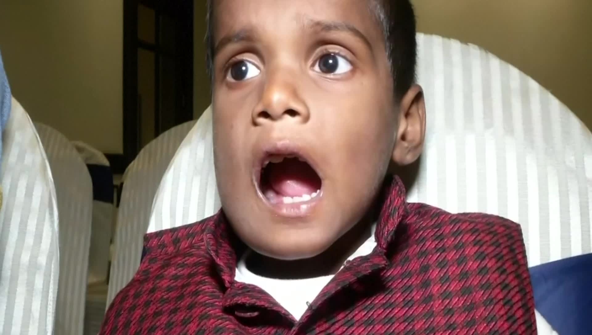 Hindistanda azyaşlının ağzından 526 diş çıxarılıb - VİDEO