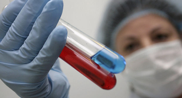 В США обнаружен редкий смертельный вирус