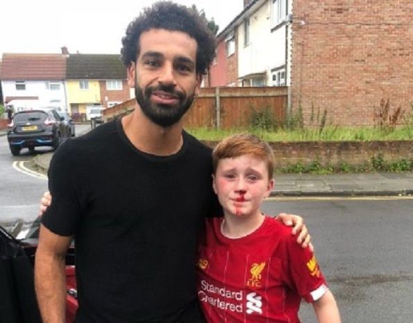 Foto üçün burnunu sındırdı: Salahdan daha bir gözəl hərəkət – FOTO